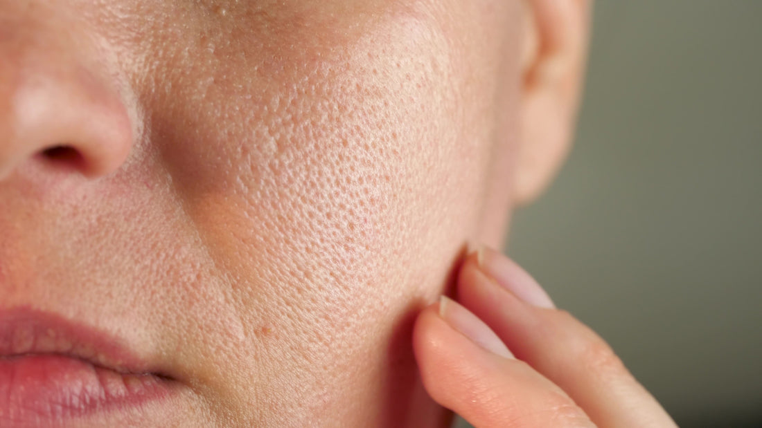 Combination Skin Care: Best Routine & Products