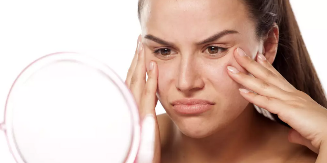 How to Deal with Combination Skin