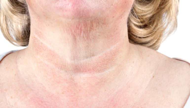 Top Skincare Products for Crepey Neck