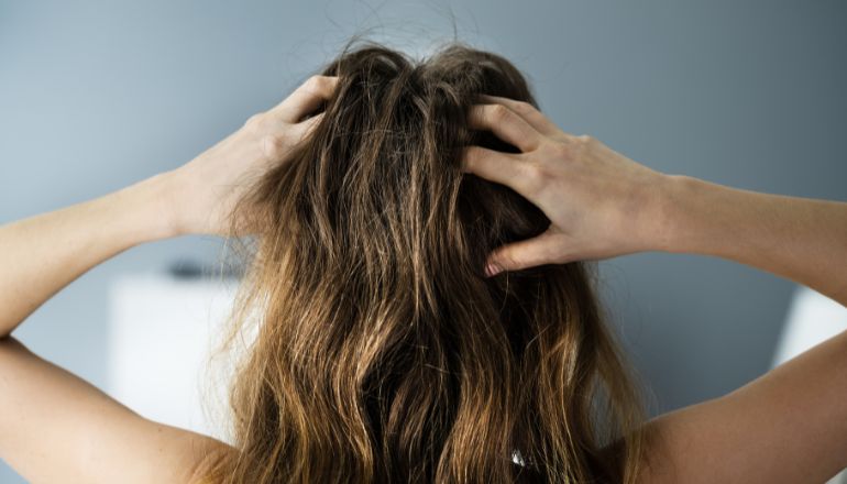 Solutions for Scalp Itch – Dermaleve