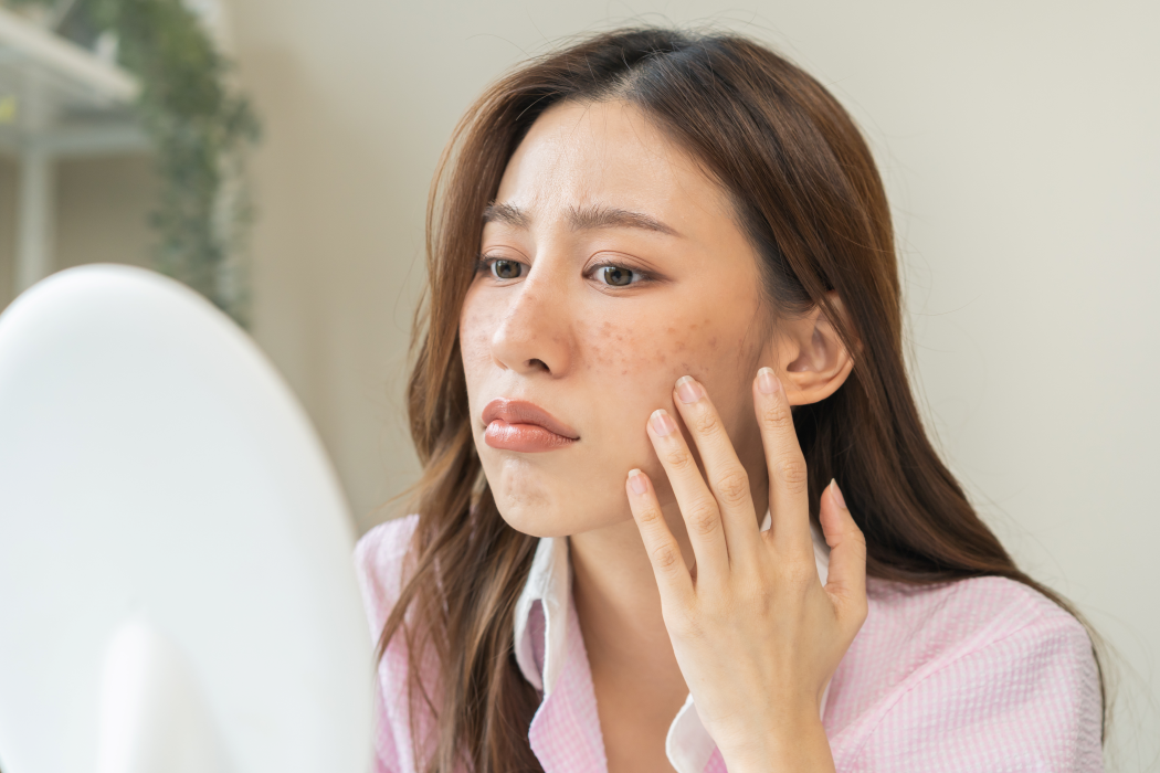 Use This, Not That: The Best Skincare for Dark Spots