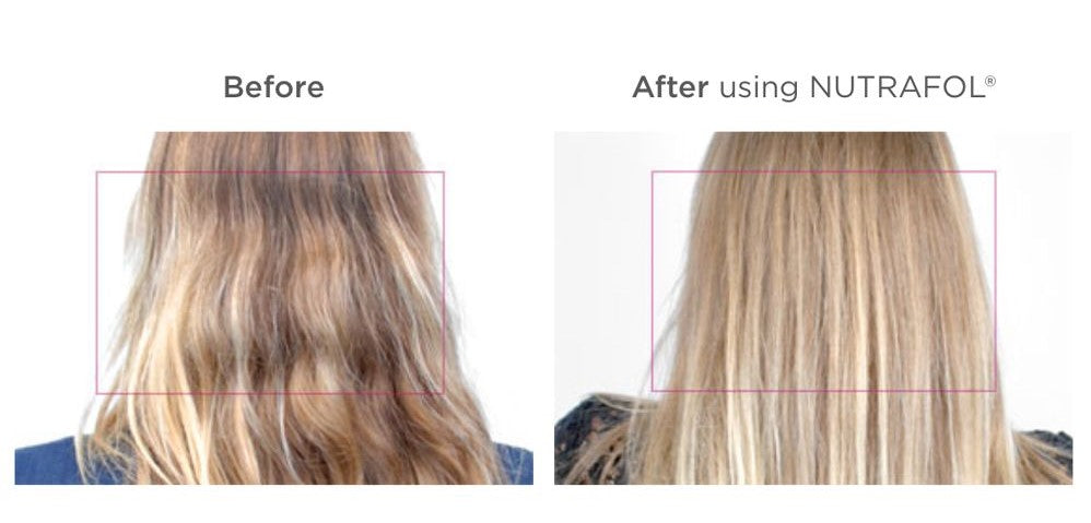 Brand Spotlight: Nutrafol Hair Growth Supplement for Women & Men