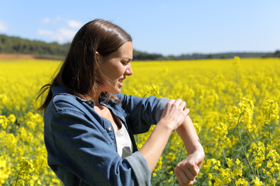 Summer Itch? Here’s What It Is and How to Treat It