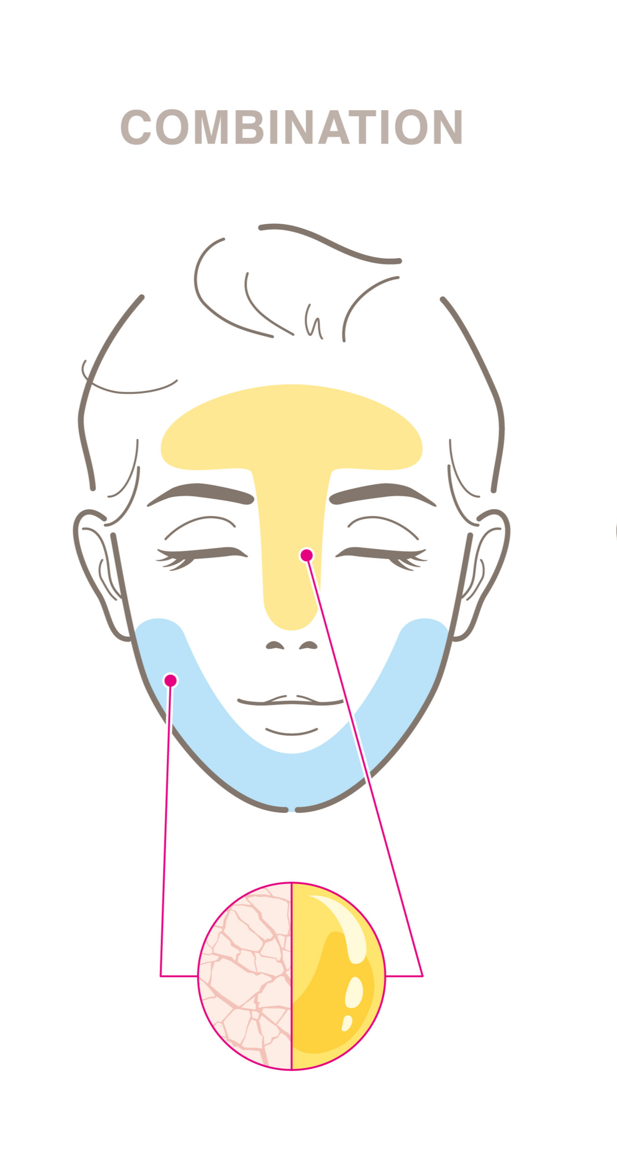 Combination Skin Type Examples Skin Type – DermSkincare